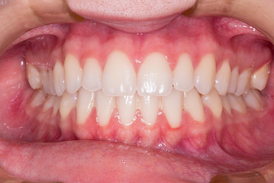 L’uso dei probiotici nella protezione del cavo orale